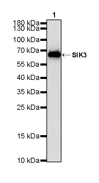 SIK3 Recombinant Rabbit mAb (S-4947-62)