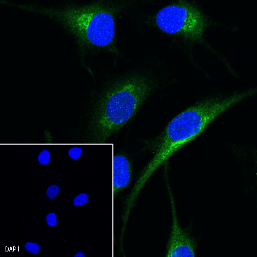 PMEL/Melanoma gp100 Recombinant Rabbit mAb (SDT-434-70)