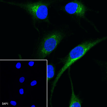 PMEL/Melanoma gp100 Recombinant Rabbit mAb (SDT-434-70)