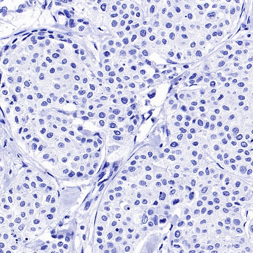 GFAP Recombinant Mouse mAb (SDT-3032)