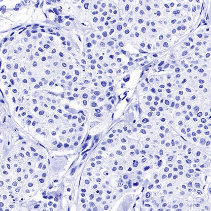 GFAP Recombinant Mouse mAb (SDT-3032)