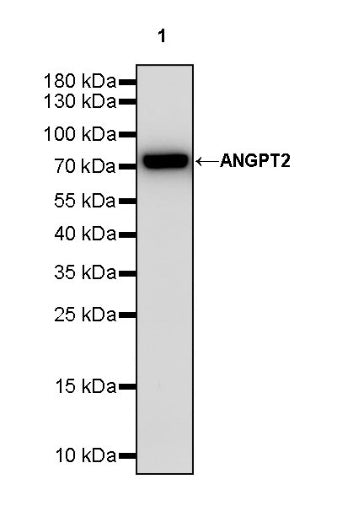 ANGPT2 Recombinant Rabbit mAb (S-1768-2)