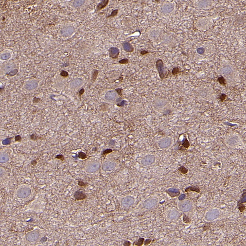 AKT2 Recombinant Rabbit mAb (S-2617-6)