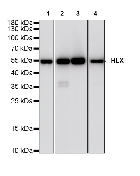 HLX Recombinant Rabbit mAb (S-4598-77)