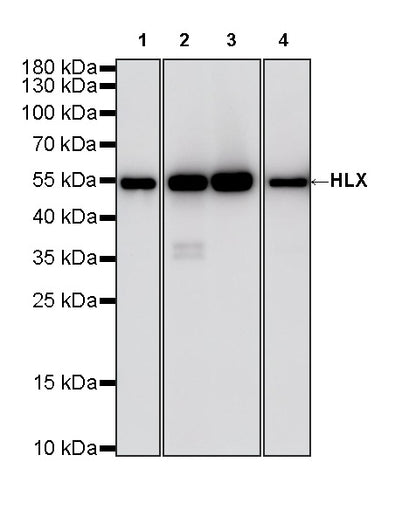 HLX Recombinant Rabbit mAb (S-4598-77)