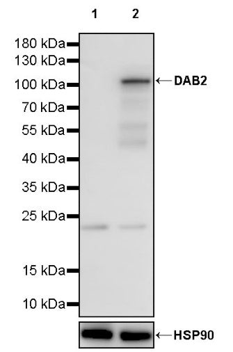 DAB2 Recombinant Rabbit mAb (S-2131-55)
