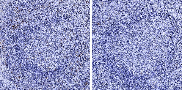 Phospho-IκBα (Ser32/36) Recombinant Rabbit mAb (S-R362)