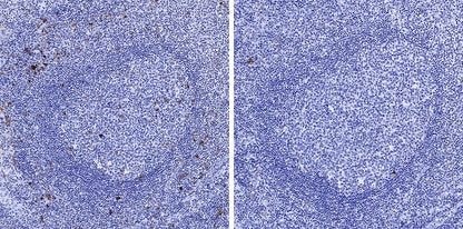 Phospho-IκBα (Ser32/36) Recombinant Rabbit mAb (S-R362)