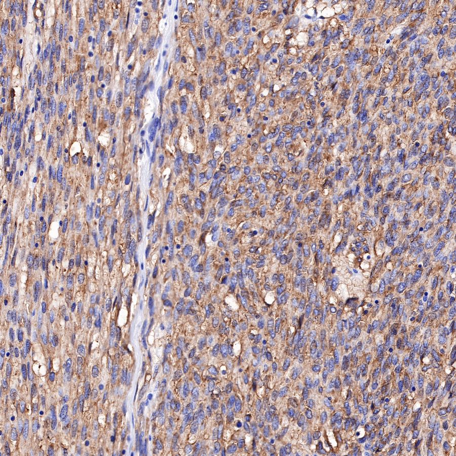 S-RMab® CD117 Recombinant Rabbit mAb,PBS Only (SDT-125-51)