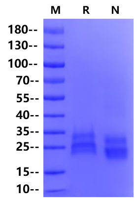 TDGF1/Cripto His Tag Protein, Human