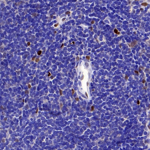 TCF-4 Recombinant Rabbit mAb,PBS Only (SDT-2549-4)