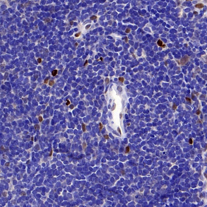 TCF-4 Recombinant Rabbit mAb,PBS Only (SDT-2549-4)