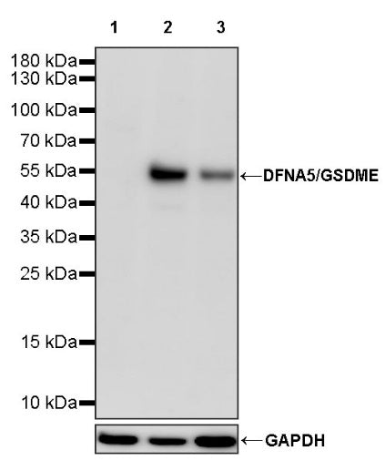 DFNA5/GSDME Recombinant Rabbit mAb (S-1703-1)