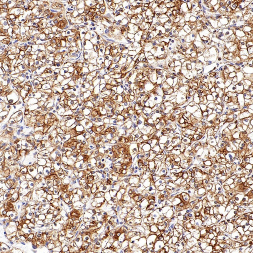 P4HB Recombinant Rabbit mAb (S-1524-120)