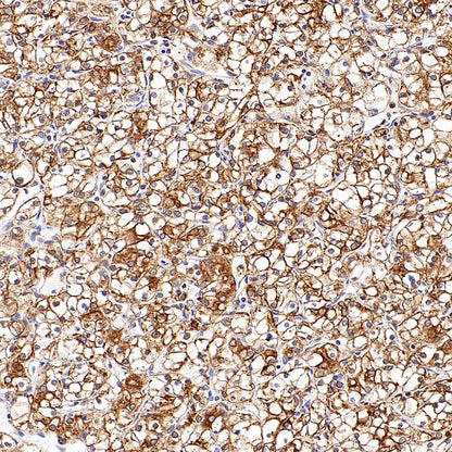 P4HB Recombinant Rabbit mAb (S-1524-120)