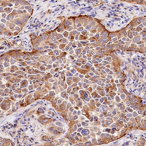 TMEM106B Recombinant Rabbit mAb (S-2362-33)