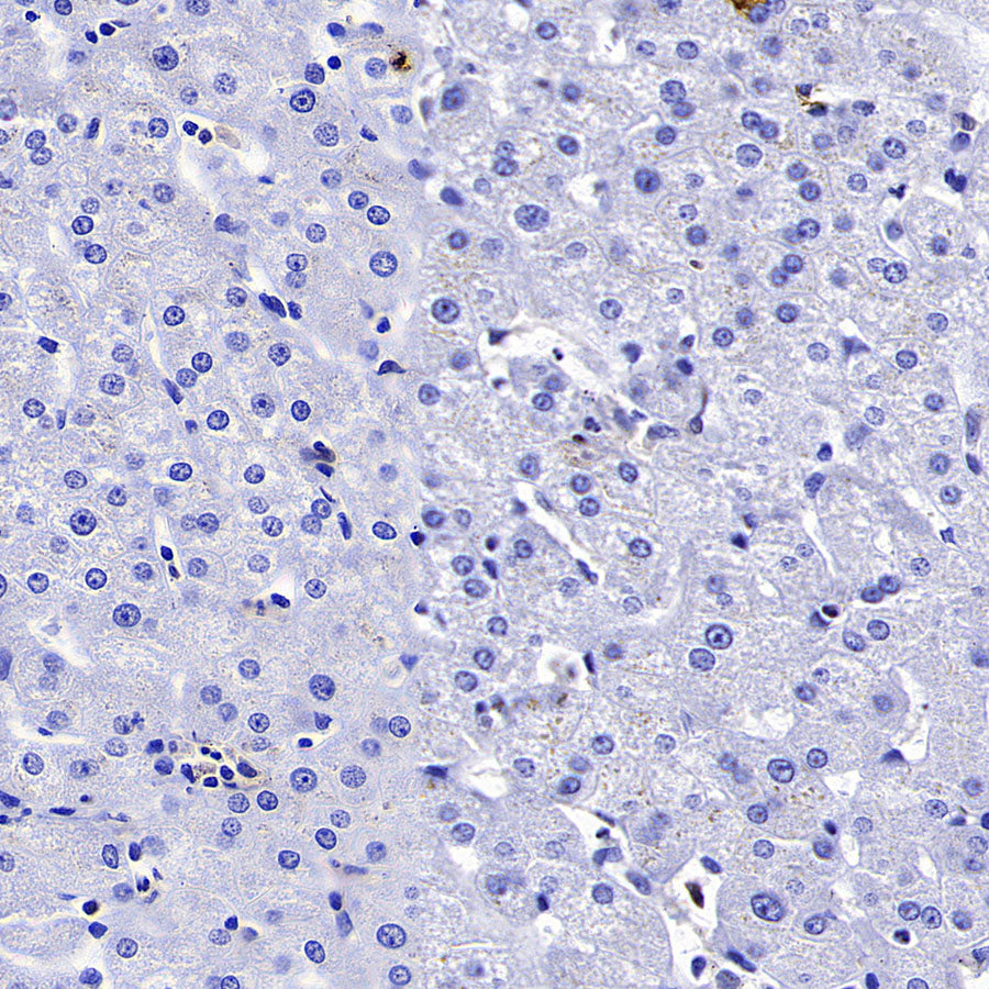 Syk Recombinant Rabbit mAb (S-4400-11)