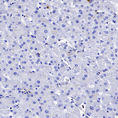 Syk Recombinant Rabbit mAb (S-4400-11)