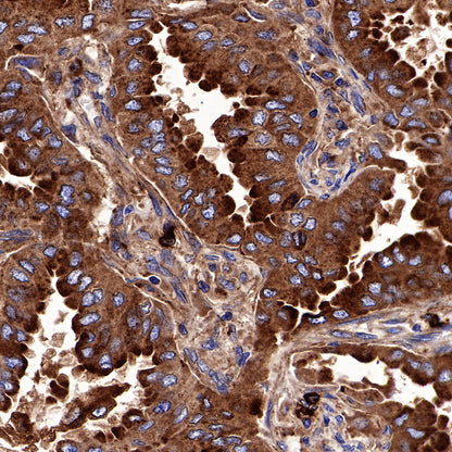 CD63 Recombinant Rabbit mAb,PBS Only (SDT-230-3)