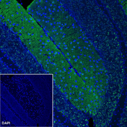 Vesicular Glutamate Transporter 1 (VGLUT1) Recombinant Rabbit mAb (S-1118-58)