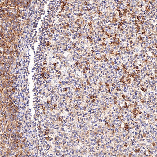 CD46 Recombinant Rabbit mAb (S-668-119)