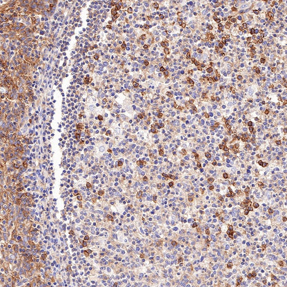 CD46 Recombinant Rabbit mAb (S-668-119)
