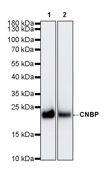 CNBP Recombinant Rabbit mAb (S-4288-3)