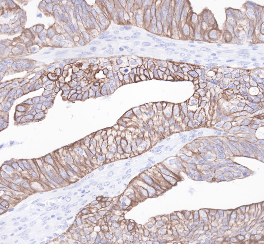 Cytokeratin 19 Recombinant Rabbit  mAb,PBS Only (SDT-107-19)