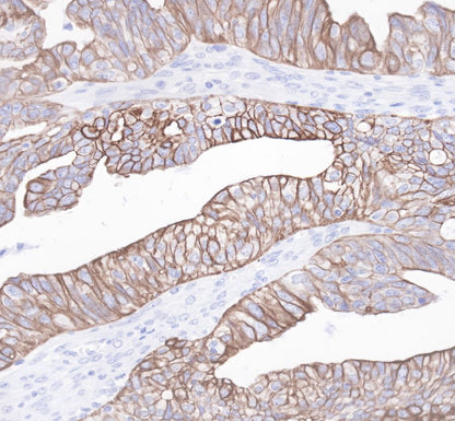 Cytokeratin 19 Recombinant Rabbit  mAb,PBS Only (SDT-107-19)