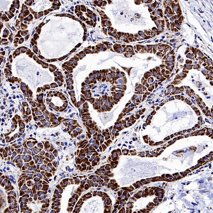 Parkin Rabbit Polyclonal Antibody