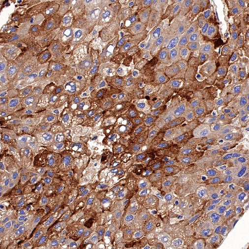 KIM-1 Recombinant Rabbit mAb (S-932-2)
