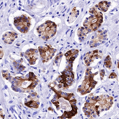 MUC4 Recombinant Rabbit mAb (SDT-R228)