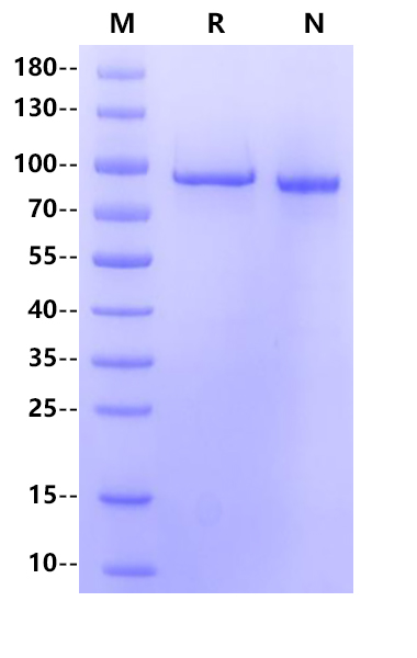 HBS1L His Tag Protein, Human