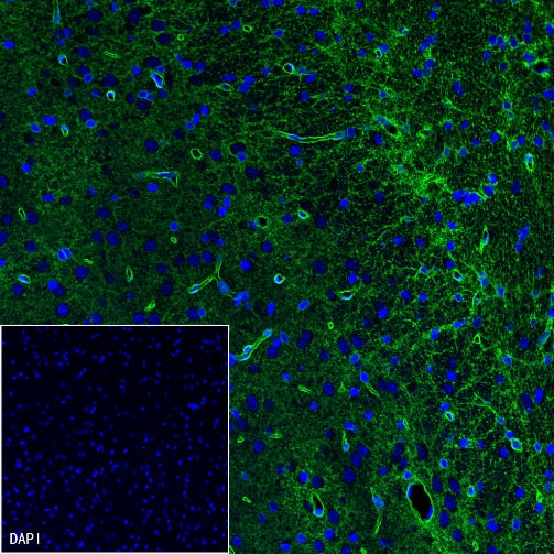 AQP4 Recombinant Rabbit mAb (S-1609-62)