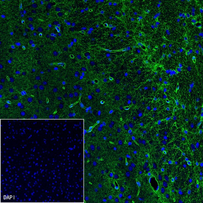 AQP4 Recombinant Rabbit mAb (S-1609-62)