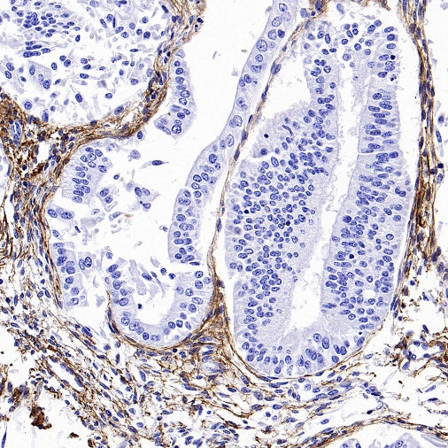 Collagen I Recombinant Rabbit mAb (S-1473-5)