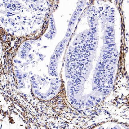 Collagen I Recombinant Rabbit mAb (S-1473-5)