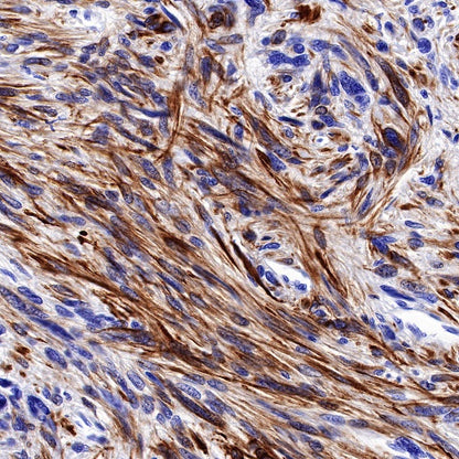S-RMab® Desmin Recombinant Rabbit mAb (SDT-109-114)