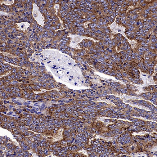 GORASP2 Recombinant Rabbit mAb (S-2526-47)