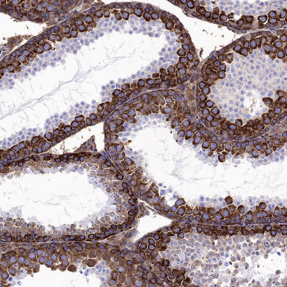 YTHDF2 Recombinant Rabbit mAb (S-1569-42)