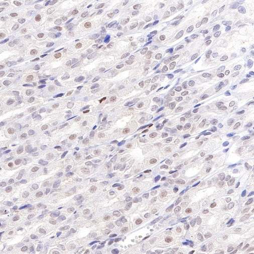 PSME1 Recombinant Rabbit mAb (S-732-14)