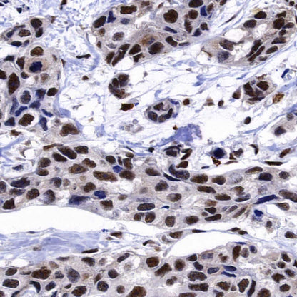 DDX39B Recombinant Rabbit mAb (S-4549-30)