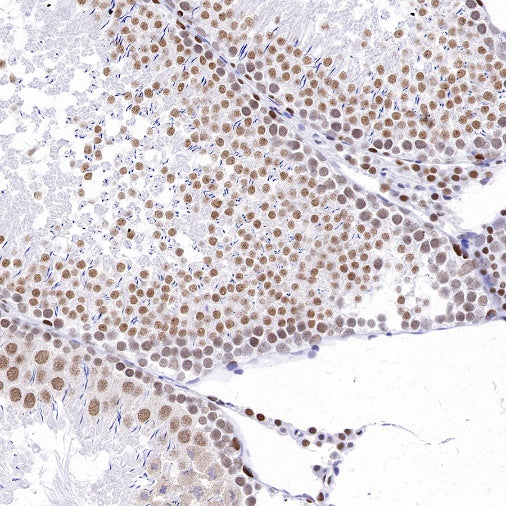 RPA70 Recombinant Rabbit mAb (S-1653-9)