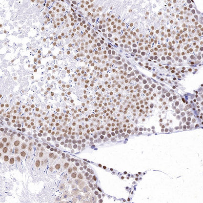 RPA70 Recombinant Rabbit mAb (S-1653-9)