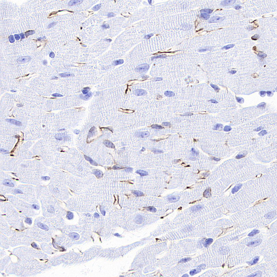 Nestin Recombinant Rabbit mAb (S-3890-61)