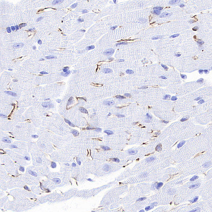 Nestin Recombinant Rabbit mAb (S-3890-61)