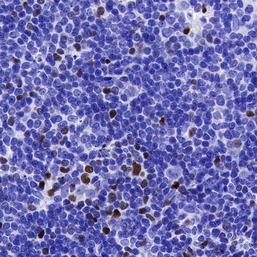 EGR2 Recombinant Rabbit mAb (S-741-136)