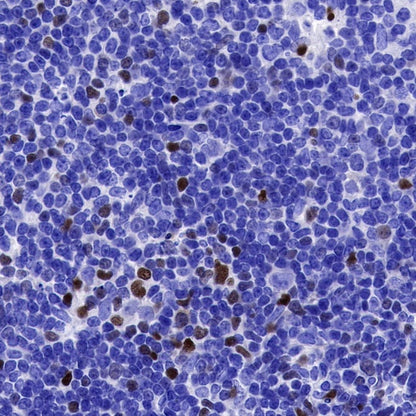 EGR2 Recombinant Rabbit mAb (S-741-136)