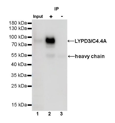 LYPD3/C4.4A Recombinant Rabbit mAb (S-R222)