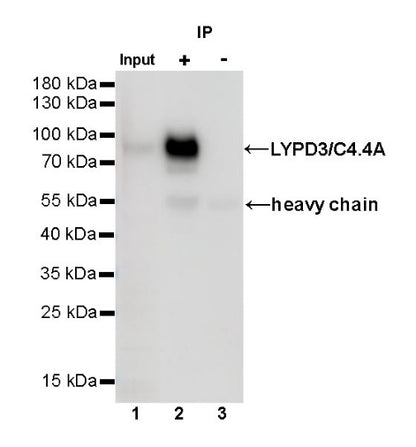 LYPD3/C4.4A Recombinant Rabbit mAb (S-R222)